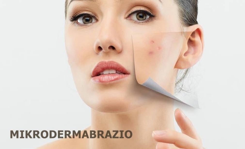 Mikrodermabrázió Mikrodermabrázió