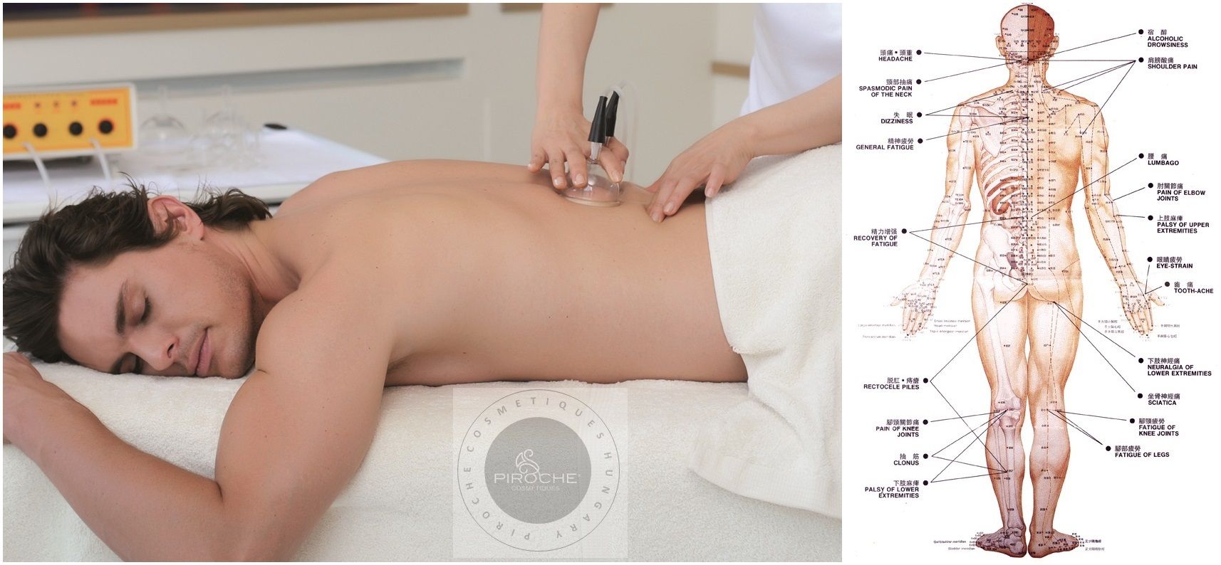 Meridian treatments